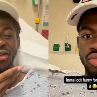 Lil Nas X é hospitalizado após perder o controle de um lado do rosto
