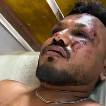 Único passageiro sobrevivente de acidente de avião na Índia é resgatado
